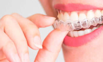 ortodoncia-invisible-clinica-dental-gil-castellon-0
