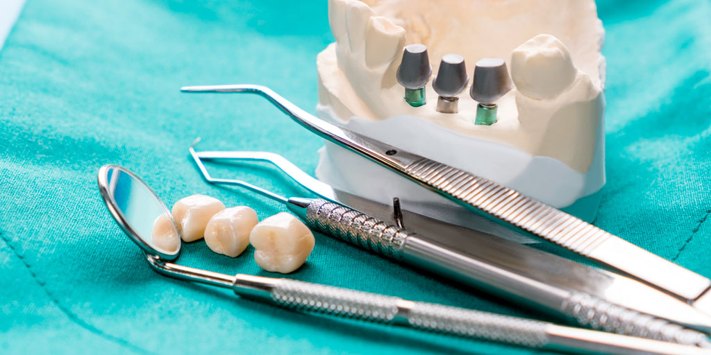 prostodoncia-clinica-dental-gil-castellon-1 prostodoncia-clinica-dental-gil-castellon-1
